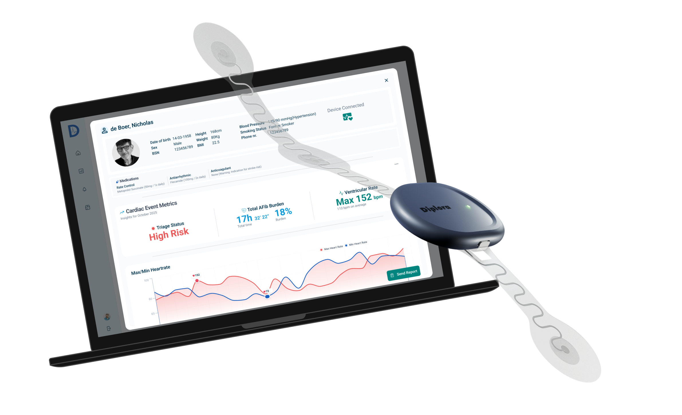 Split image showing a 3-lead wearable patch next to a high-fidelity rendering of the final Diplora Triage Console